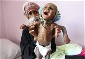 شهادت ۱۴۰۰ کودک یمنی از ابتدای تجاوز سعودی ها