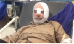 حسین‌ الله‌کرم در تصادف به شدت مصدوم شد